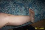 leg and foot
