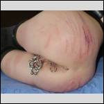 piercing de salope - #1986561-2