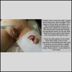 Those two little glands were what make a man a man.