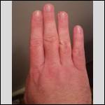 My finger length comparison My finger length comparison
