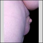 Micropenis photos - #1991905-1