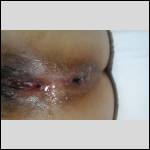 After Close up