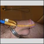sonde urinaire , visite gyneco - #1986400-2
